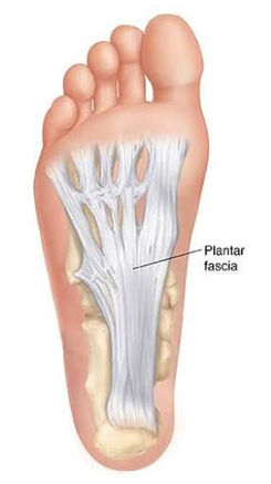 PLANTAR FASCIITIS - Travancore Ayurveda Blog